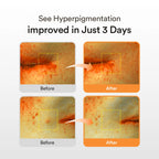 ABIB Glutathiosome Dark Spot Serum Vita Drop