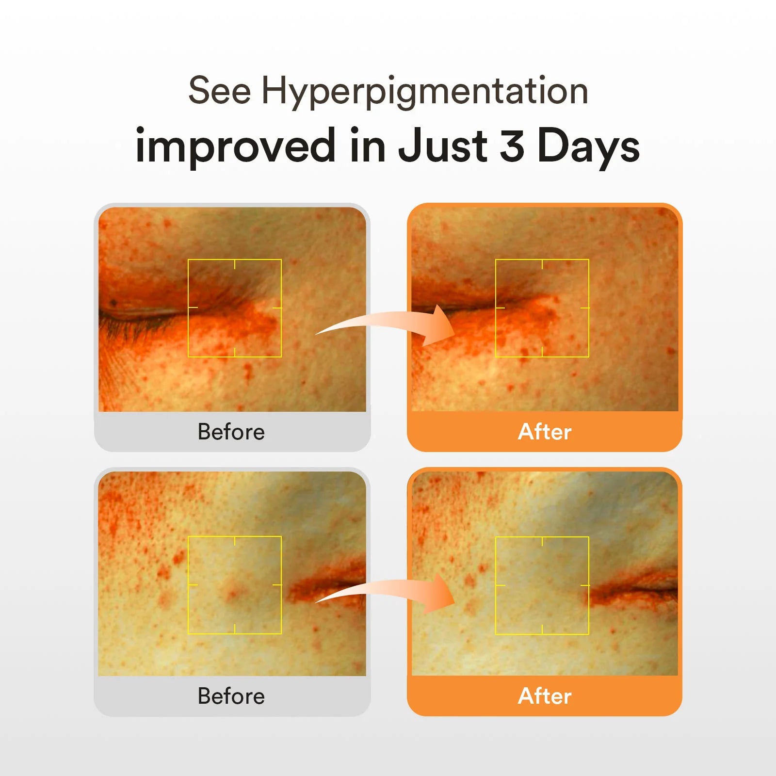 ABIB Glutathiosome Dark Spot Serum Vita Drop