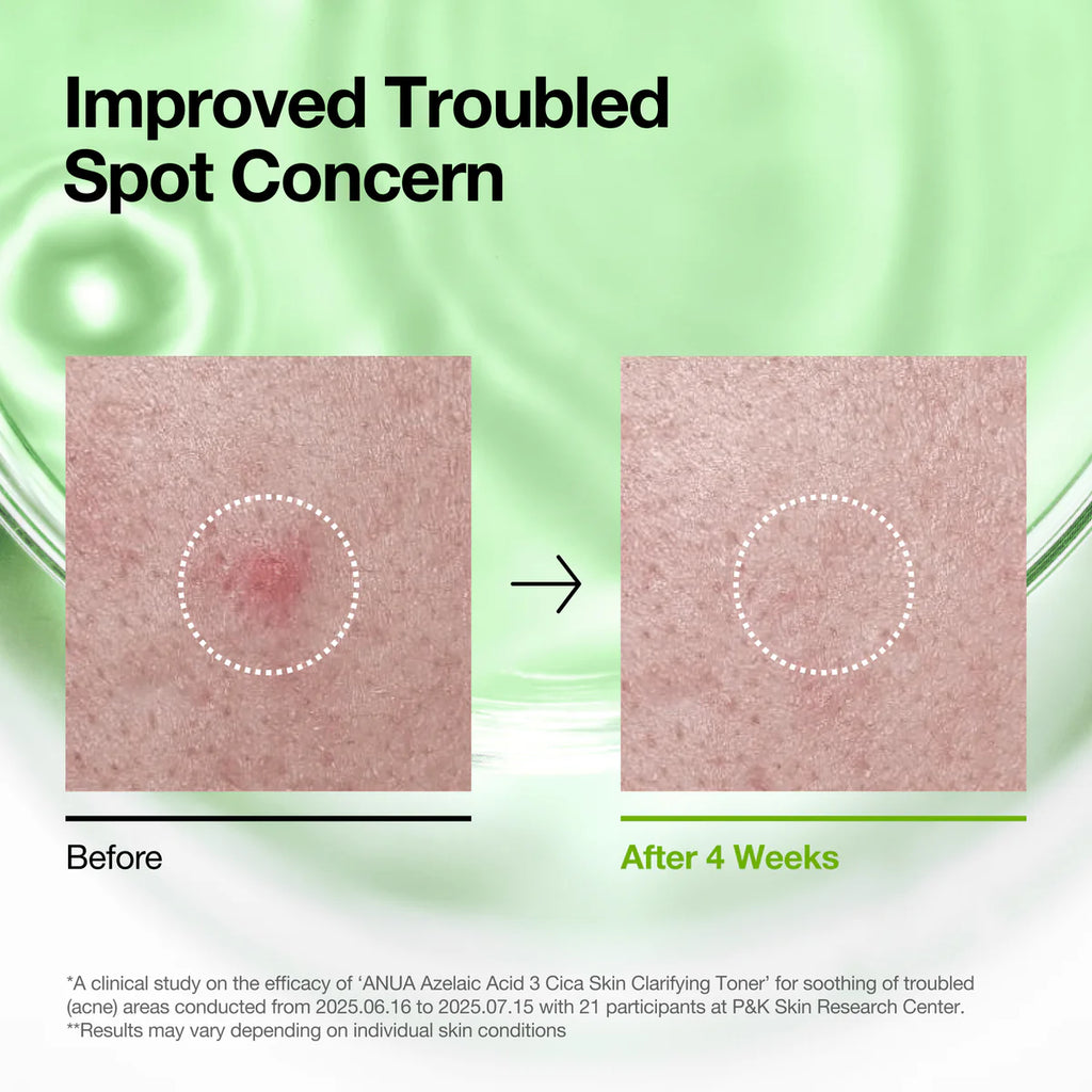 ANUA Azelaic 3 Cica Skin Clarifying Toner 250ml