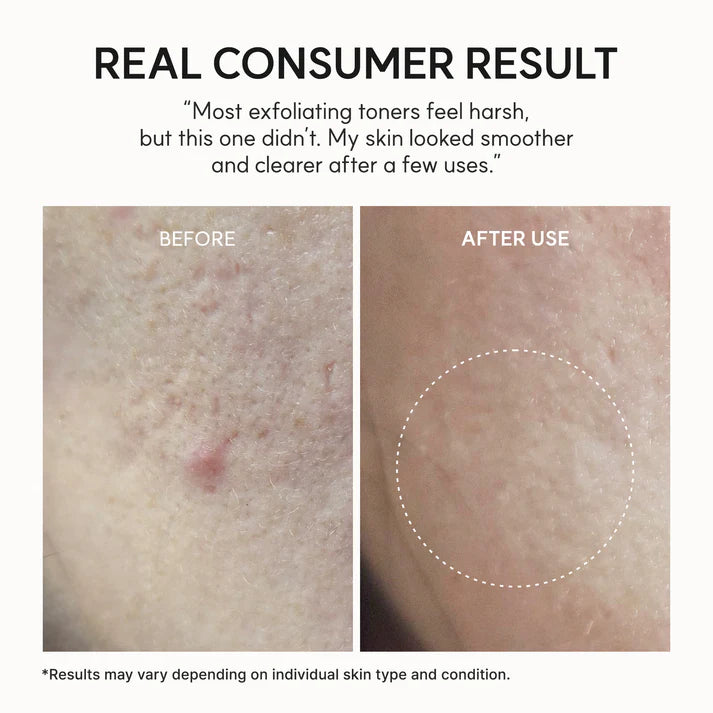 ARENCIA Eraser Shot Glycolic Acid Exfoliator 200ml