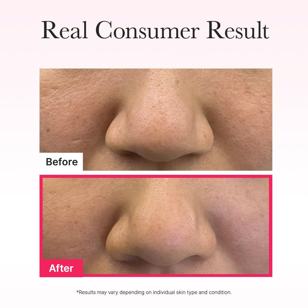 ARENCIA Red Collagen Jello Mask (25G*4EA)