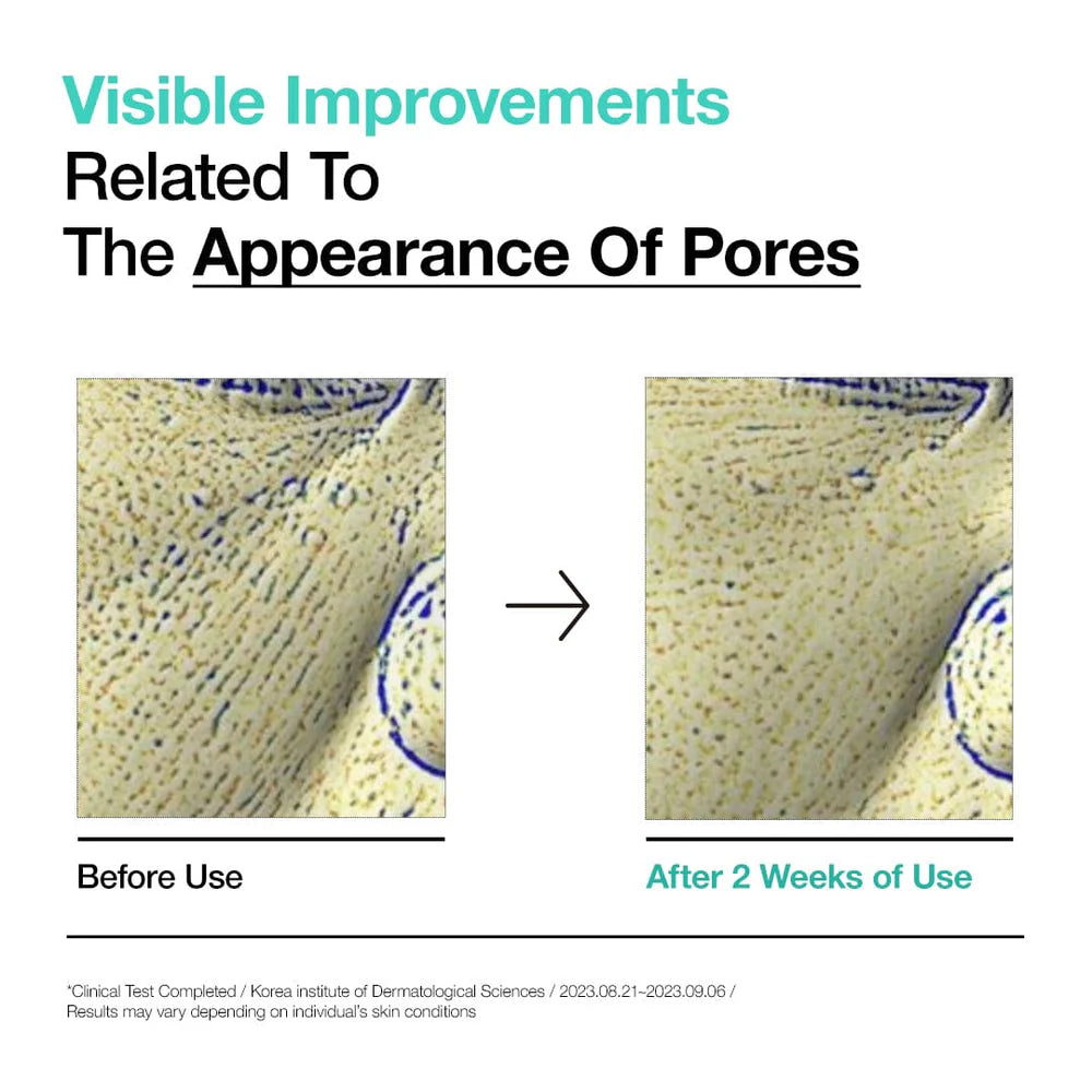 ANUA BHA 2% Gentle Exfoliating Toner