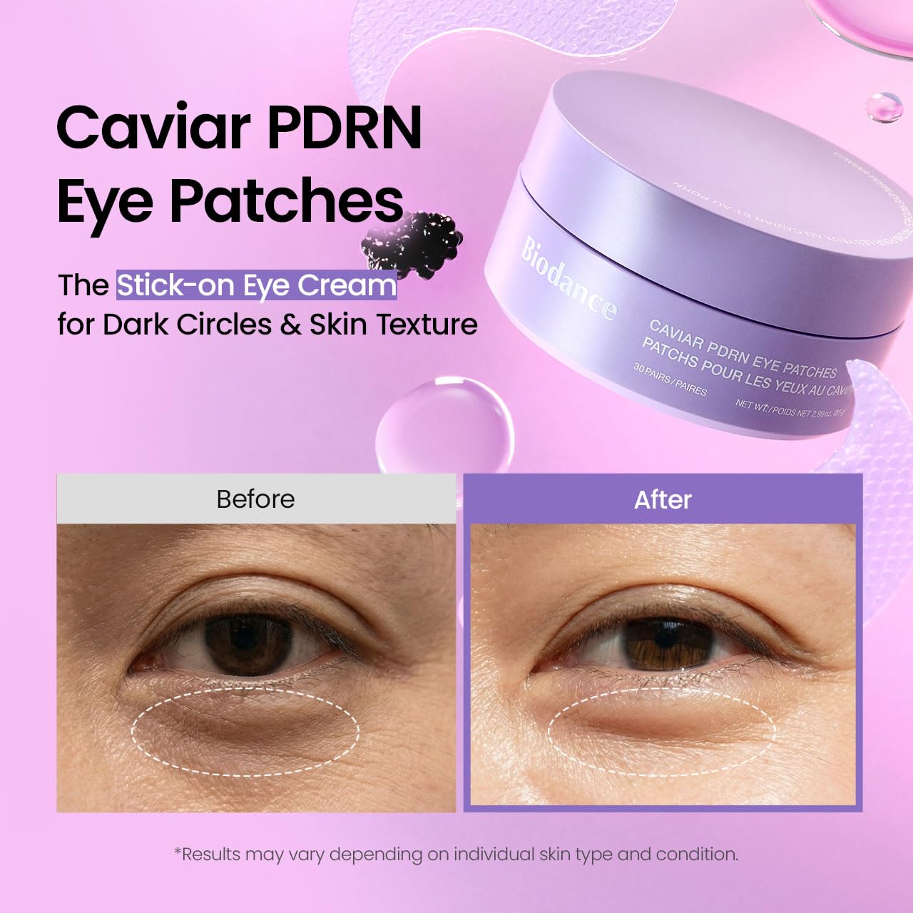 BIODANCE Caviar PDRN Eye Patches (30ea)