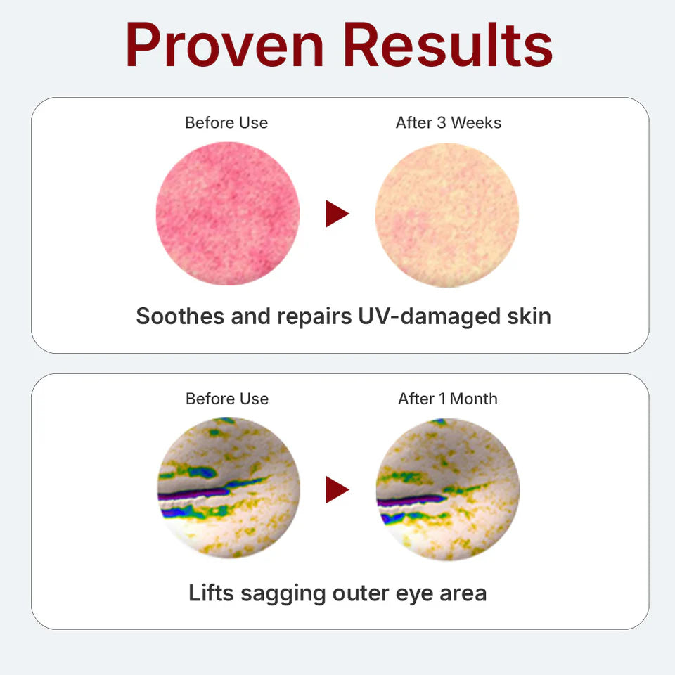 CENTELLIAN24 Madeca Derma Mask III Intensive Formula (23ml x 10pcs)