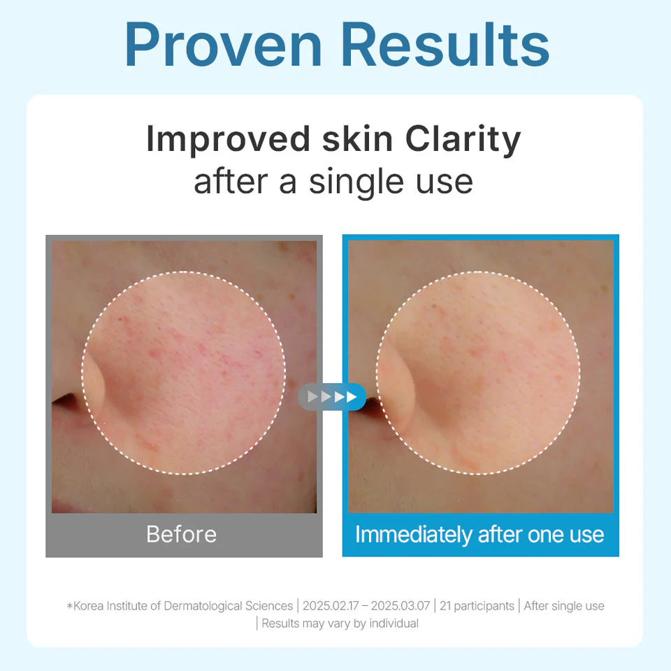 CENTELLIAN24 Madeca Lab Hyal Waterfull Glow Gel Mask