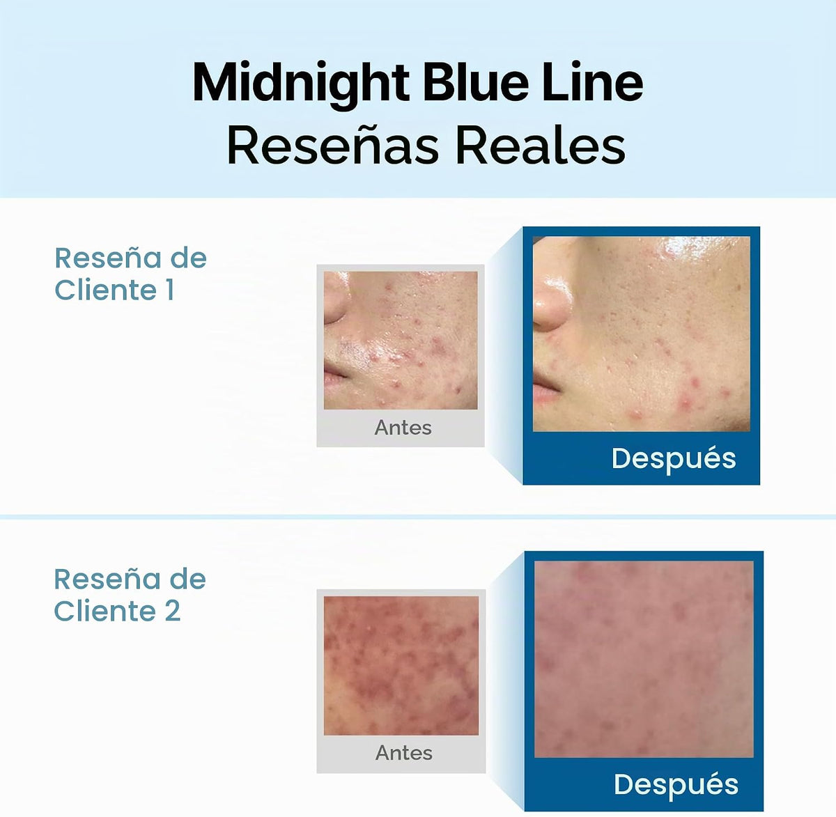 DEAR KLAIRS Midnight Blue Calming Cream 60g