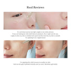 DR.ALTHEA Skin Relief Essence 30ml