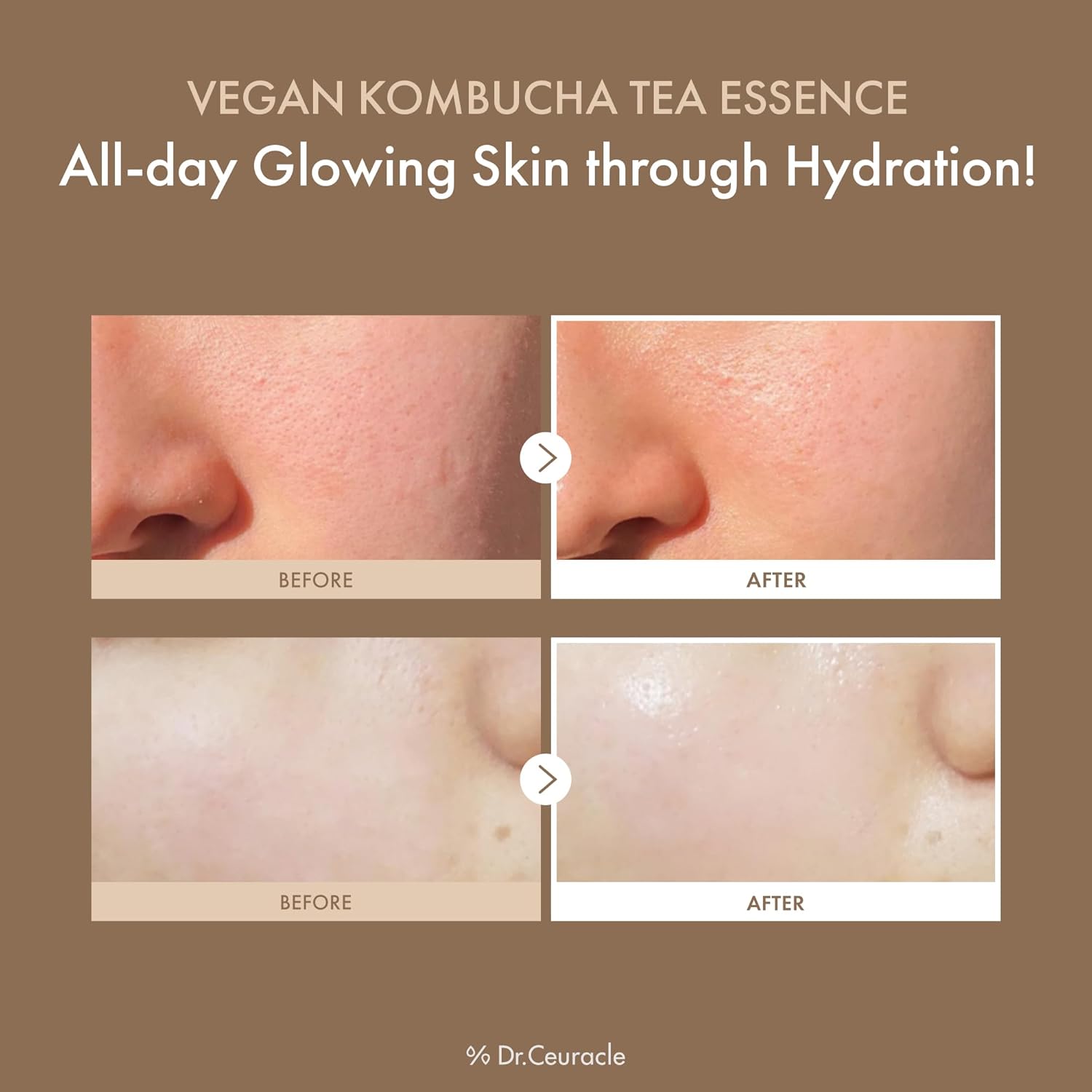 DR.CEURACLE Vegan Kombucha Tea Essence 150ml