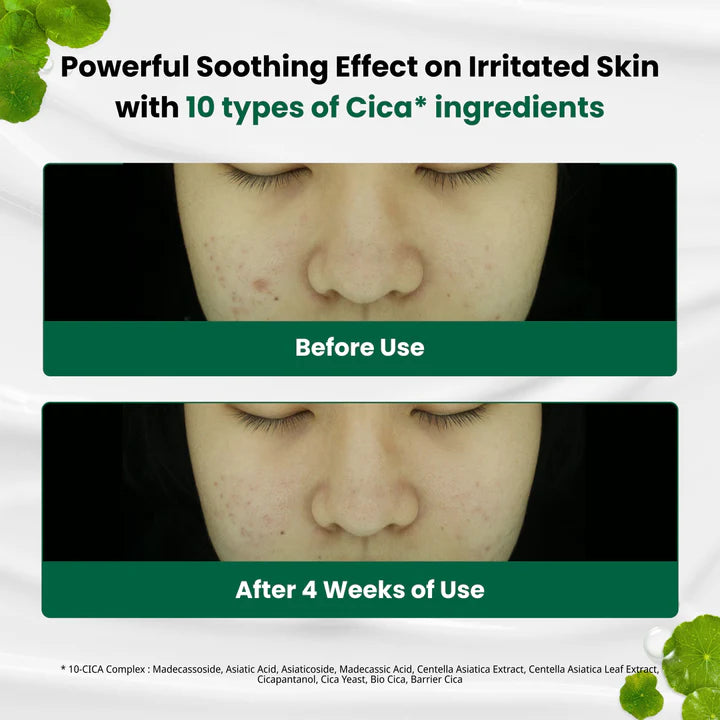 DR.G Red Blemish Clear Soothing Cream 70ml