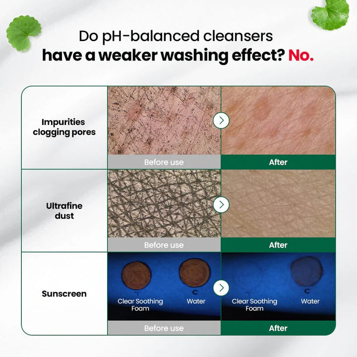 DR.G Red Blemish Clear Soothing Foam 150ml