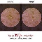 DR.MELAXIN Peel Shot Glow White Rice Ampoule 80ml
