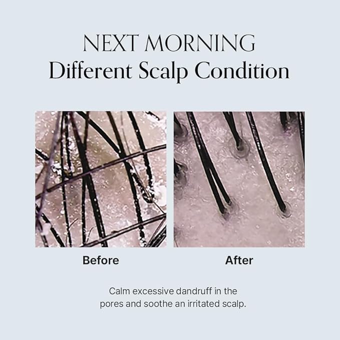 GROWUS Damage Therapy Scalp Scaling Ampoule 30ml