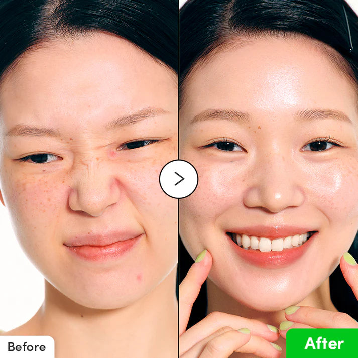 EQQUALBERRY Aloe PDRN Calming Serum 30ml