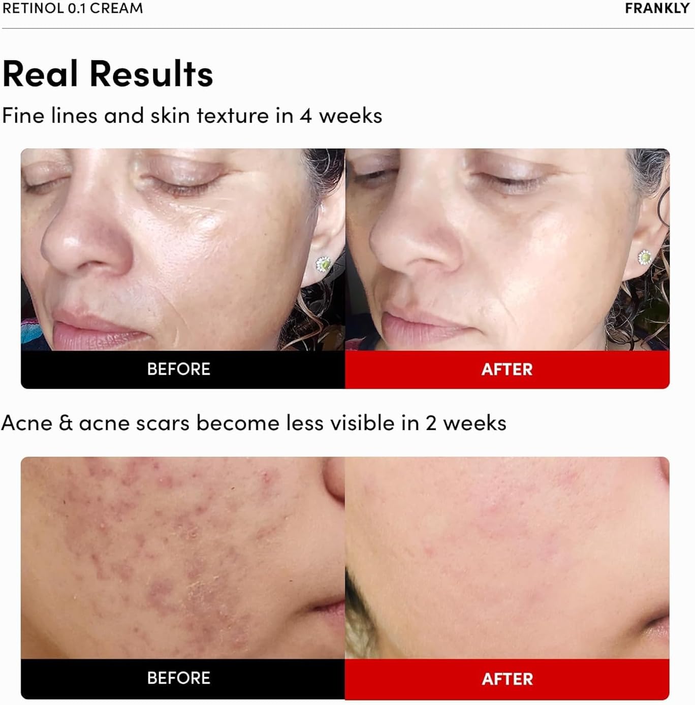 FRANKLY Retinol 0.3% Cream 20ml