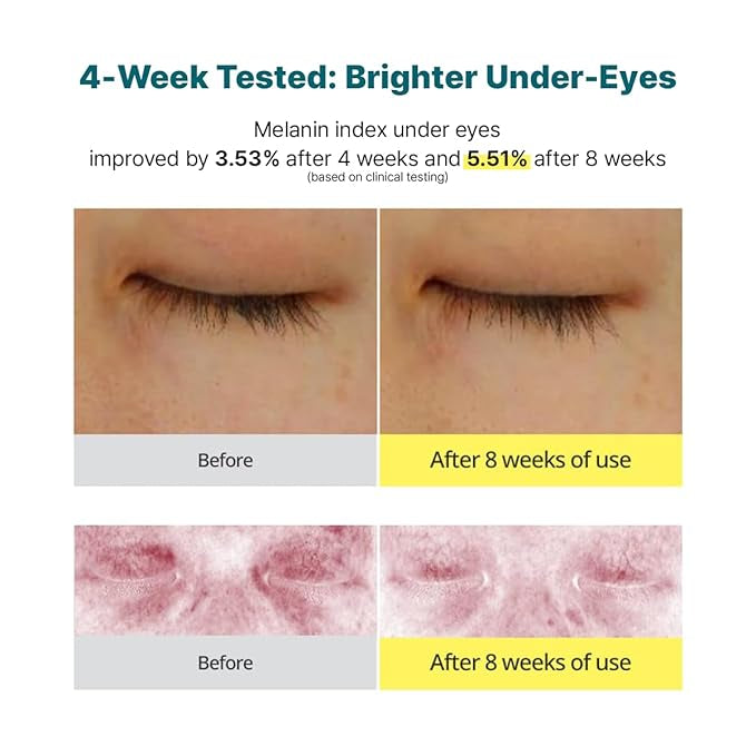 GOODAL Green Tangerine Vitamin C Dark Circle Eye Cream 30ml