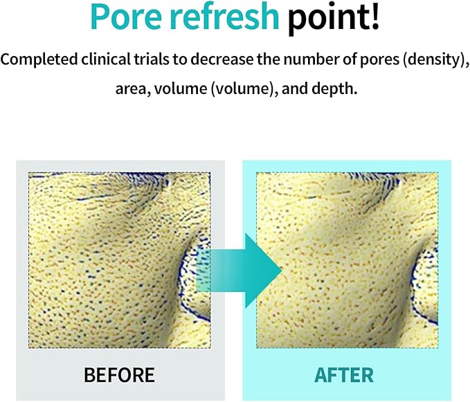 ILSO Moringa Tightening Pore Serum 30ml