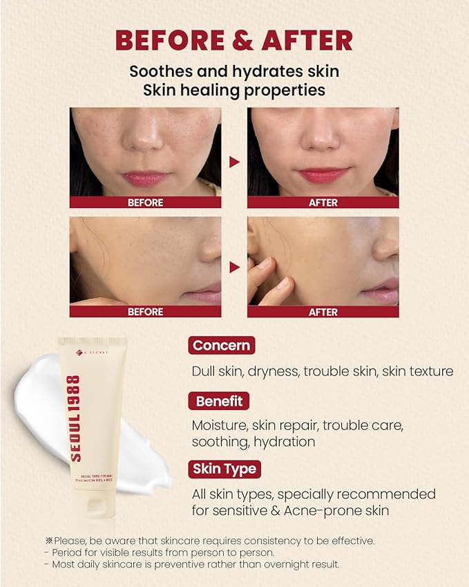 K-SECRET SEOUL 1988 Cream : Snail Mucin 93% + Rice 100ml