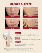 K-SECRET SEOUL 1988 Essence : Snail Mucin 97% + Rice 100ml