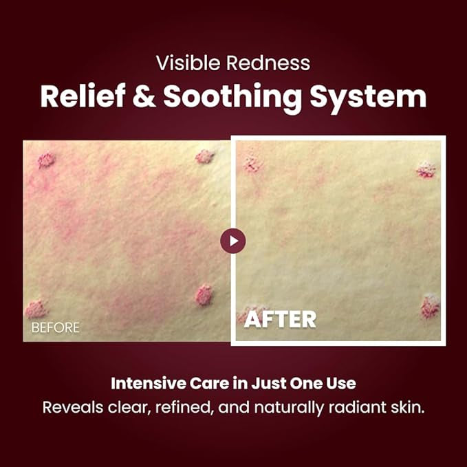 KOPHER Curepair Melder SOS System Cream 1.5ml*20ea(30ml)