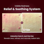 KOPHER Curepair Melder SOS System Cream 1.5ml*20ea(30ml)