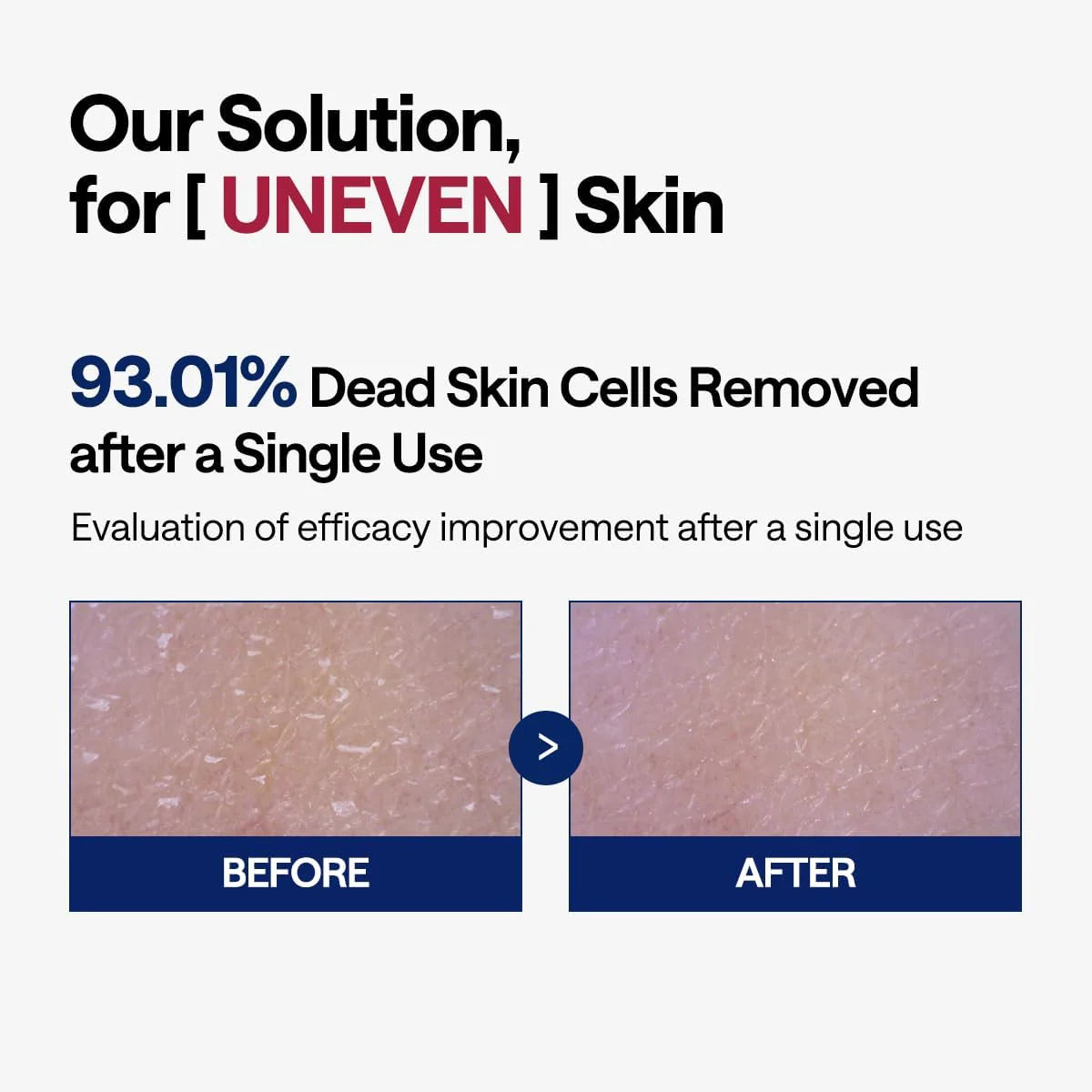 MEDIHEAL Photo-Enzyme Peeling Pad (100pads)