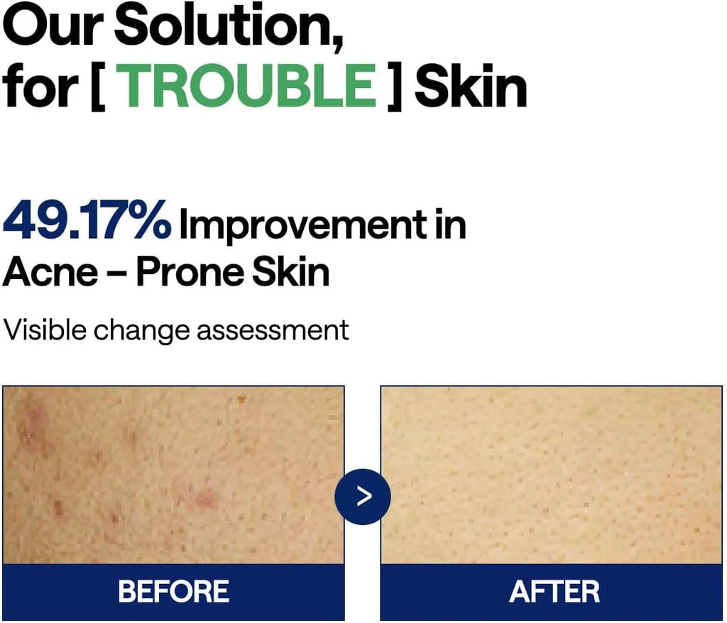 Mediheal Teatree Trouble Pad 100pads
