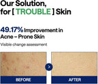 Mediheal Teatree Trouble Pad 100pads