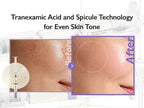 GENABELLE Melacare Spicule toning Shot Ampoule 1ml*3pcs