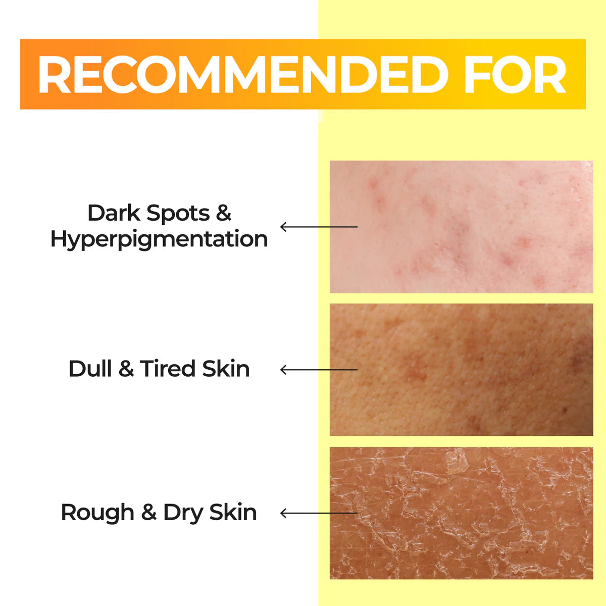 NUMBUZIN No.5 Vitamin Boosting Essential Toner