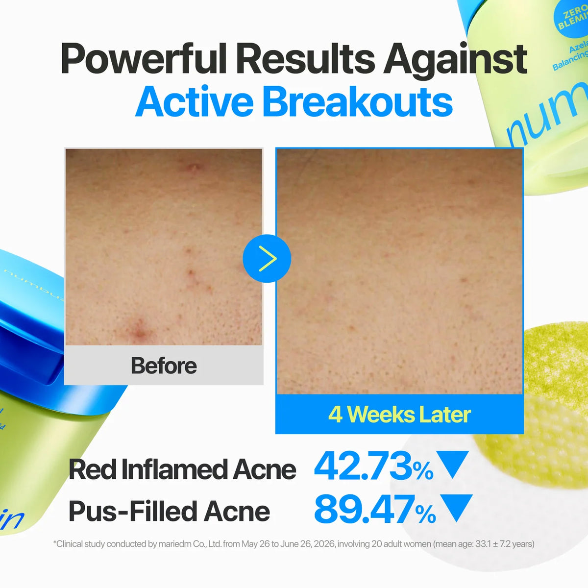 NUMBUZIN Zero Blemish Azela Cica Balancing Dual Pads 210ml