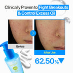 NUMBUZIN Zero Blemish Oil-Free Micellar Cleansing Jelly 200ml