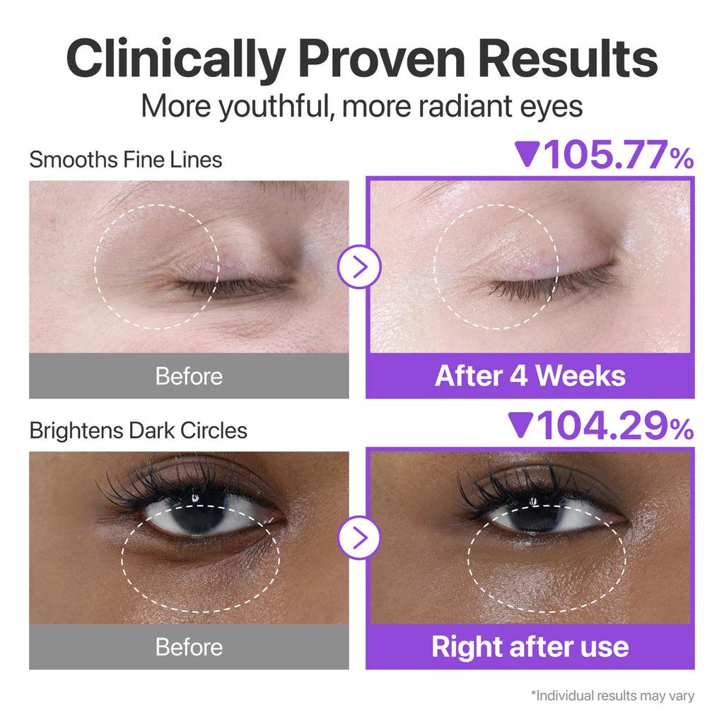 NUMBUZIN No.9 NAD+ Retinol Volumetox Eye Cream 10ml