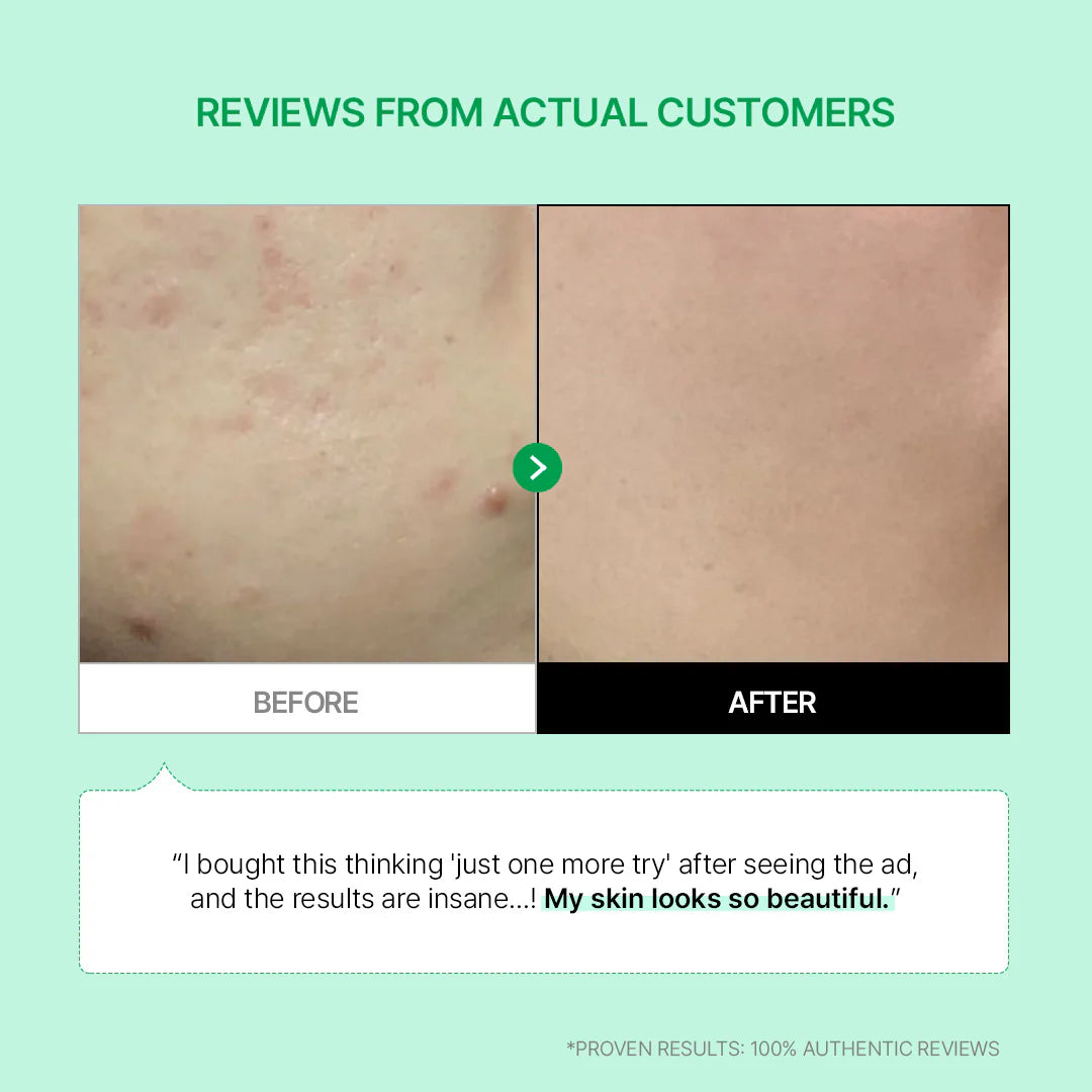 PARNELL Cicamanu 92 Serum 30ml