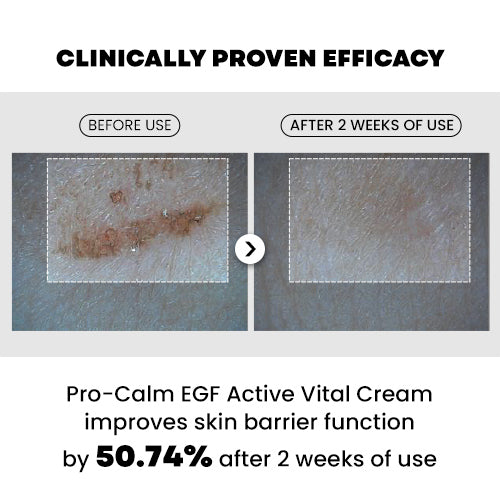 PROCALM EGF Active Vital Cream 20ml