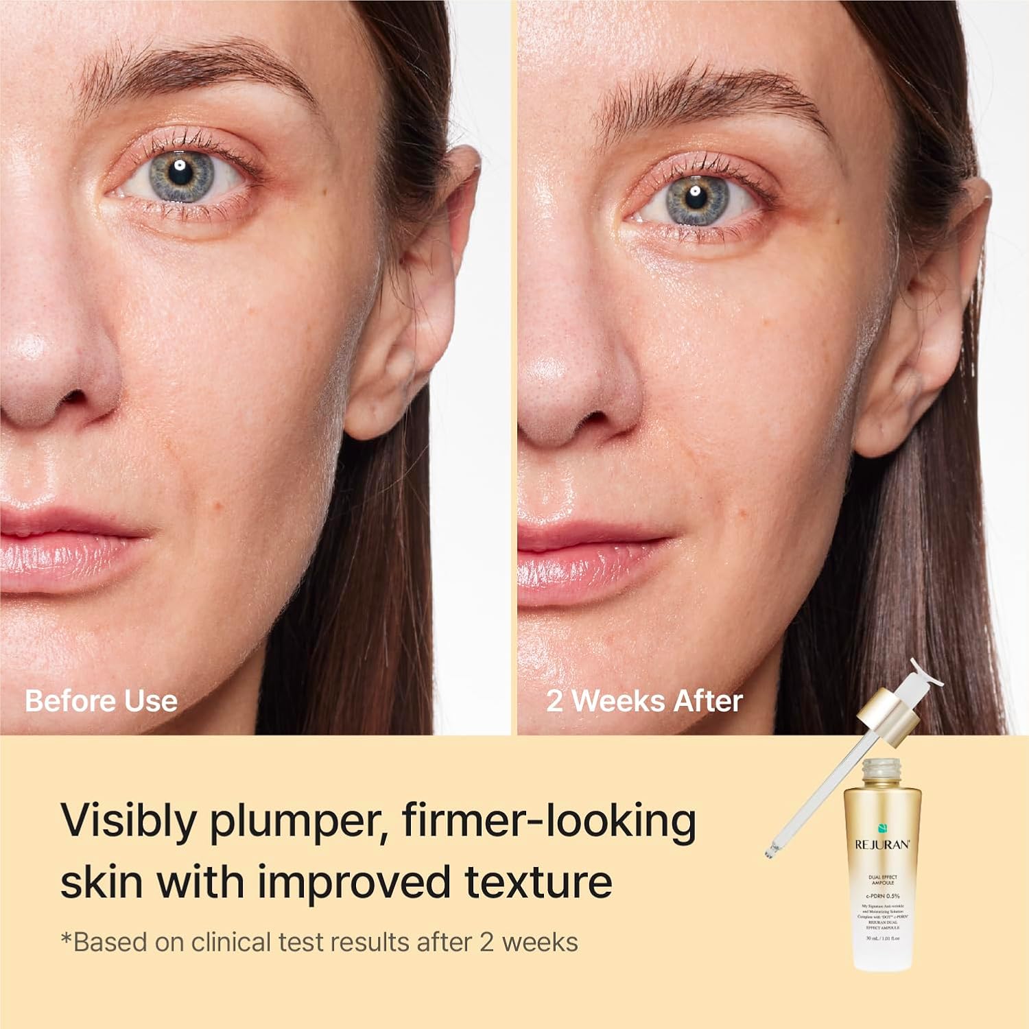 REJURAN Healer Dual Effect Ampoule 30ml