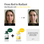 ROUND LAB Vita Niacinamide Dark Spot Serum 30ml