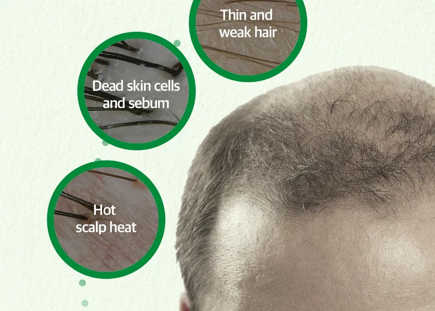 SOME BY MI Cica Peptide Anti Hair Loss Derma Scalp Tonic 150ml